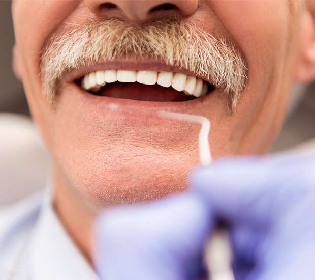 Pleasant Grove Adjusting to New Dentures