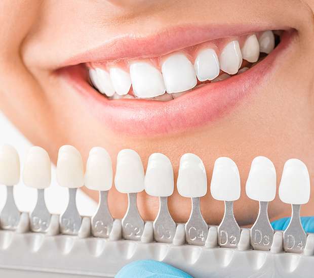 Pleasant Grove Cosmetic Dentist