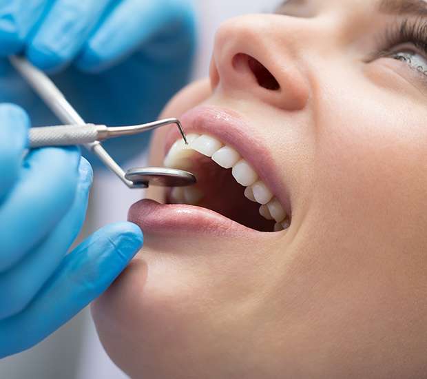 Pleasant Grove Dental Bonding