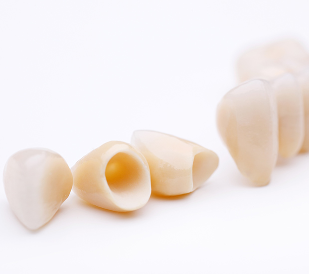 Pleasant Grove Dental Crowns and Dental Bridges