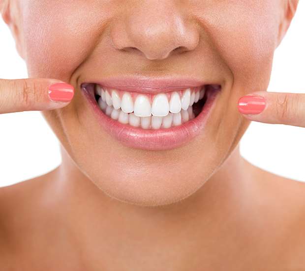 Pleasant Grove What Is Gum Contouring & Reshaping