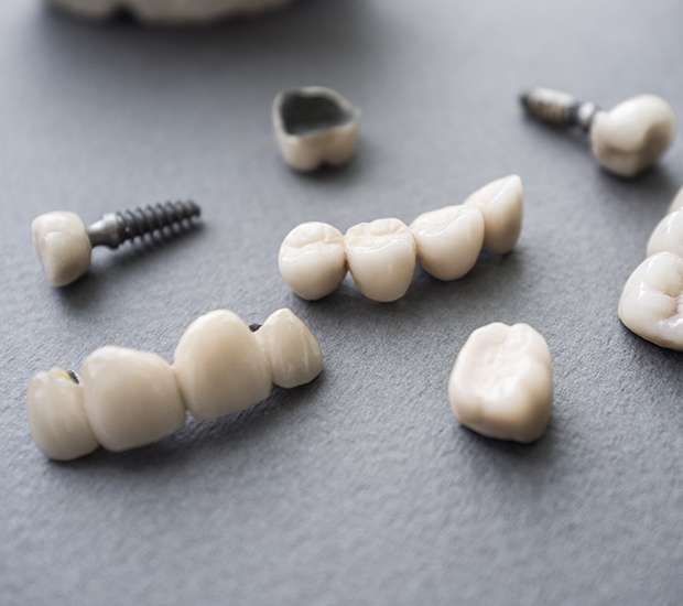 Pleasant Grove The Difference Between Dental Implants and Mini Dental Implants