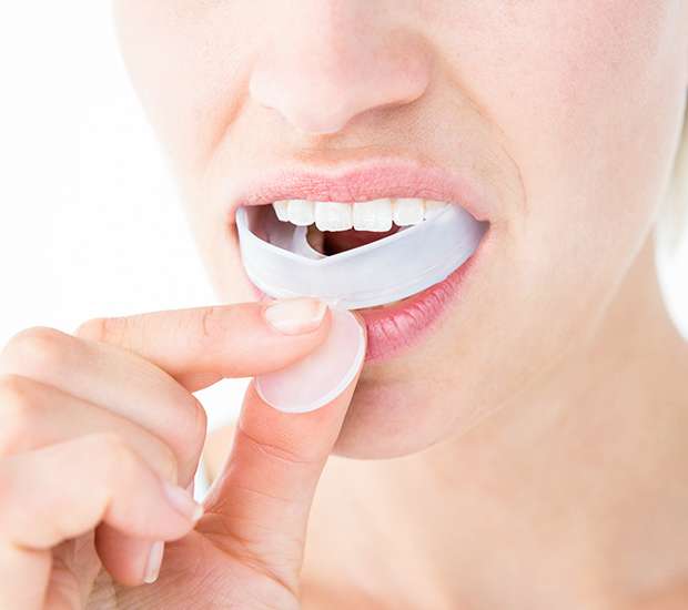 Pleasant Grove Mouth Guards