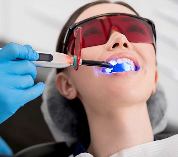 Pleasant Grove Professional Teeth Whitening